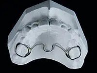 Transpalatal Arches (TPA)