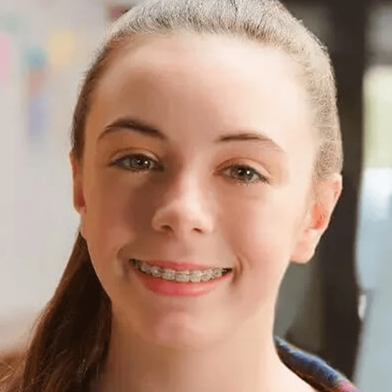 Orthodontic FAQs